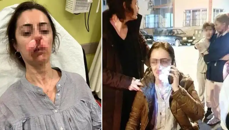 Otomobil Kapısının Saldırıda Rolü: Eşinin Sevgilisi Zannedilen Kişiye Sıçrayan Olay